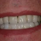 Immagine 4 azienda STUDIO DENTISTICO BORRELLI DOTT. FABRIZIO Salute in Livorno