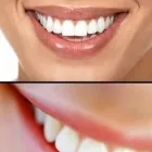 Immagine 2 azienda STUDIO DENTISTICO MARCATO GALDINO Salute in Conselve PD