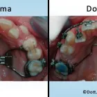 Immagine 1 azienda STUDIO ODONTOIATRICO DOTTOR GIOVANNI DEL CORONA Salute in Livorno